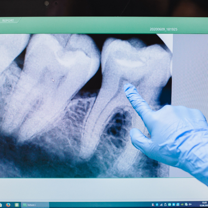 Un odontólogo de pie frente a un monitor de 32".

En pantalla aparece una radiografía panorámica muy limpia.

El especialista sostiene un stylus o señala el monitor.

No mira a cámara.

Está completamente concentrado.

Todo el consultorio tiene acabados premium.

Madera.

Blanco cálido.

Cristal.